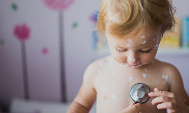 Child with Chickenpox
