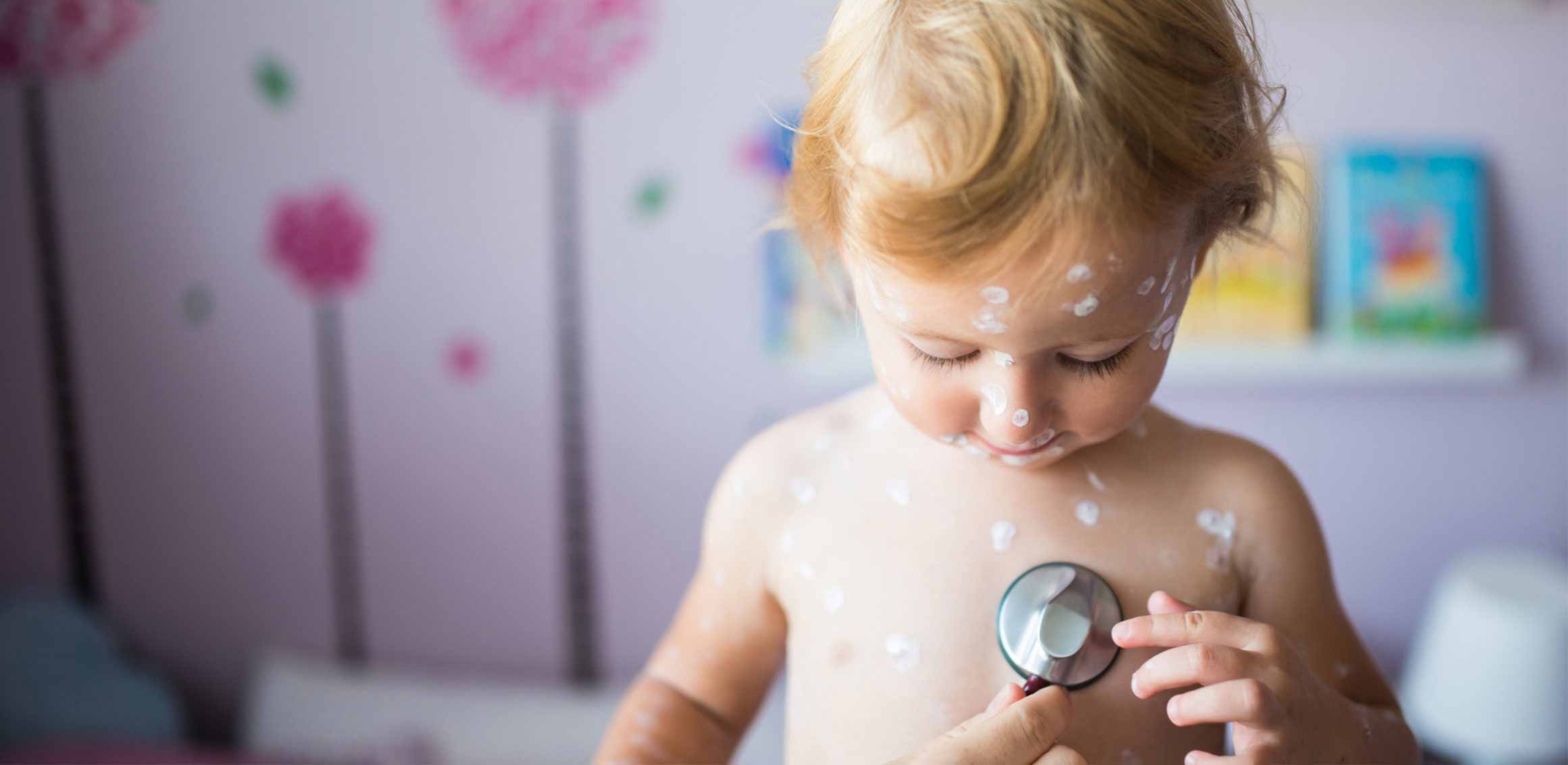 Child with Chickenpox